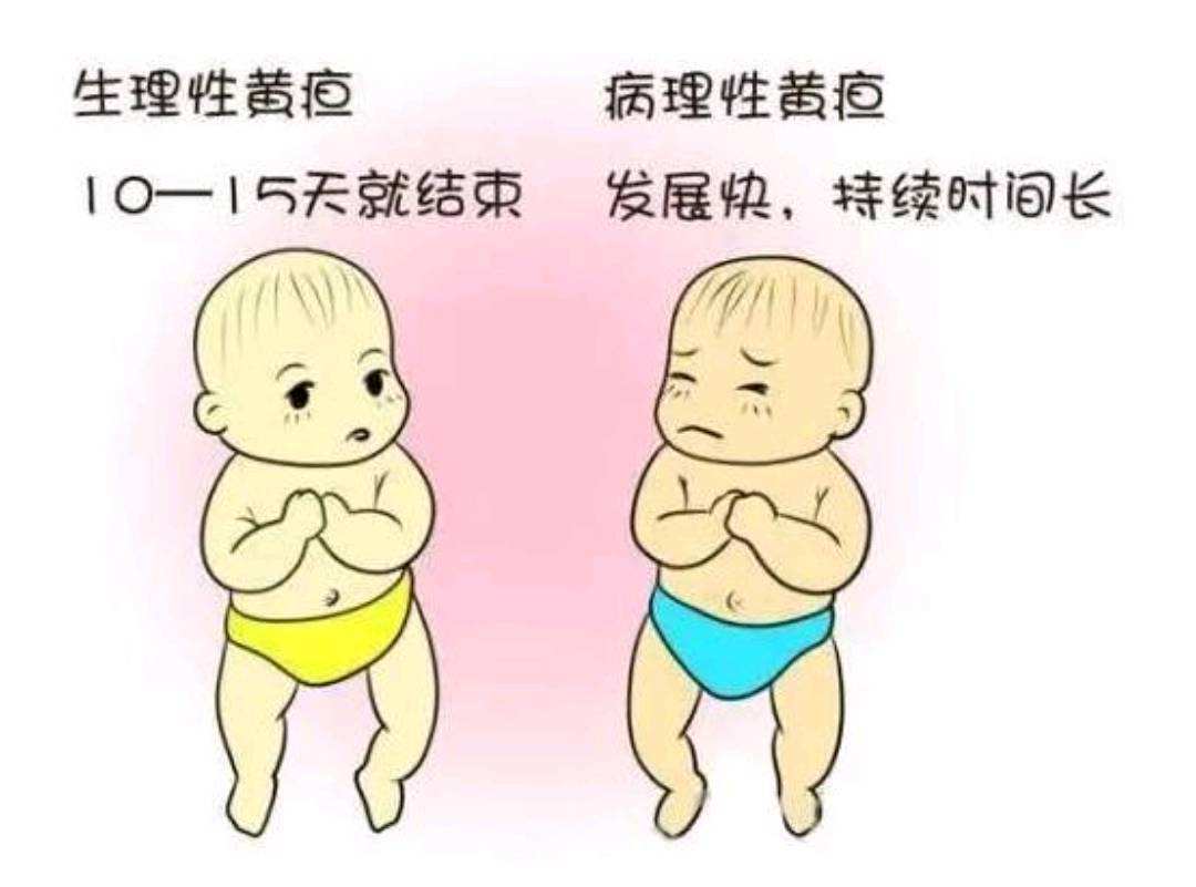 新生儿生理性黄疸怎么护理?-健康家园-广东医科大学顺德妇女儿童医院